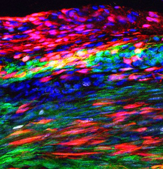부상후 30일이 지난 환자의 슬개골 힘줄 모습. 힘줄 줄기세포(빨간색)가 원래 힘줄 세포(초록색) 위에 겹쳐 새로운 힘줄 세포(노란색,오렌지색)로 분화된다. CIS 홈페이지