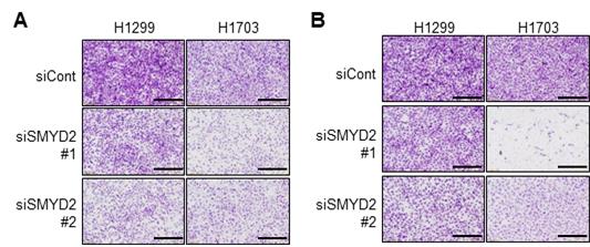 SMYD2 단백질에 의한 폐암 이동 및 침윤 억제 확인(세포실험)